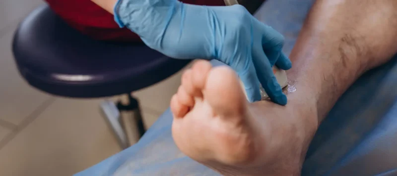 Diabetisches-Fußsyndrom-header